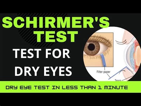 shrumers tear test|schirmer's test for eyes.